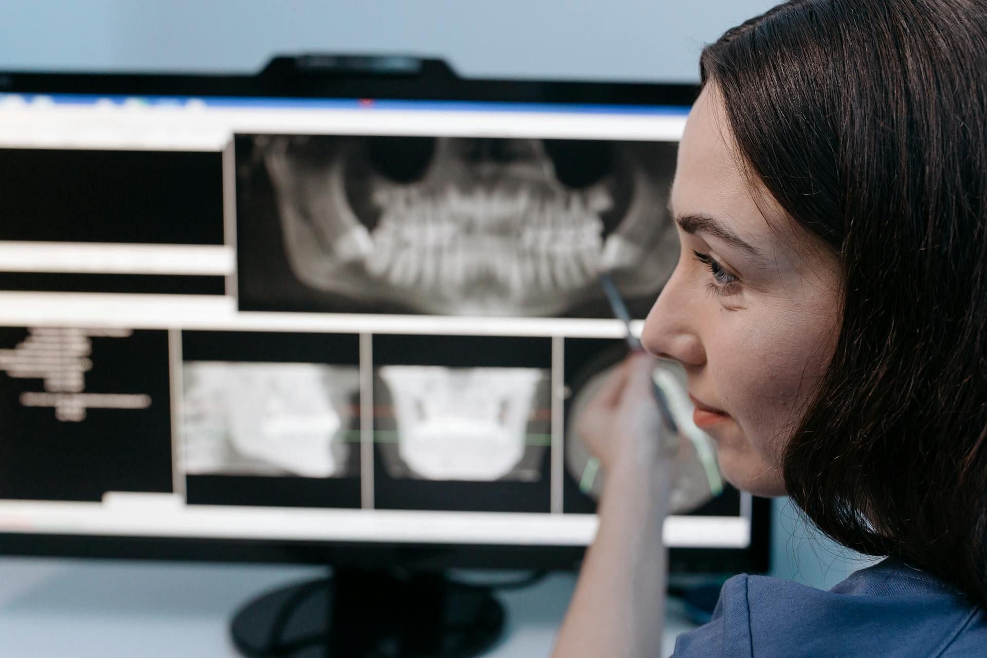Forensic examination found a gunshot wound on the head of the victim (Image via Pexels)